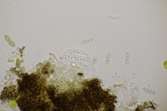 Monascostroma innumerosum