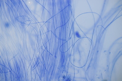 Acrospermum compressum