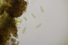 Monascostroma innumerosum