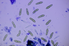 Monascostroma innumerosum