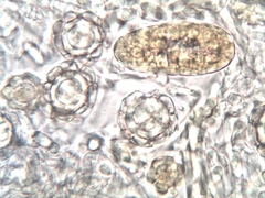 Hypomyces papulasporae