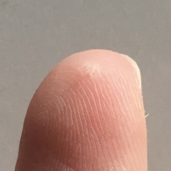 Firstpapillomavirinae