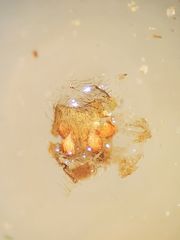 Tetragnatha versicolor