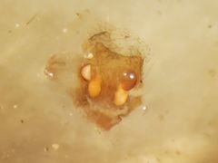 Tetragnatha versicolor