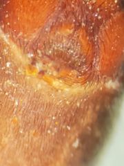 Castianeira alteranda