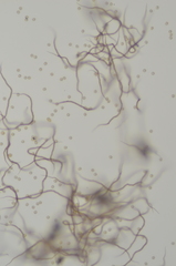 Trichia botrytis