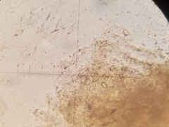 Phaeocystis