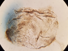 Phaeocystis