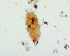 Echiniscus