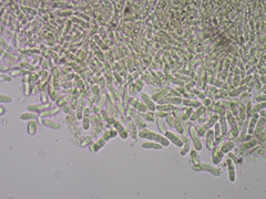 Microcalicium disseminatum
