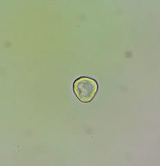 Cocconeis