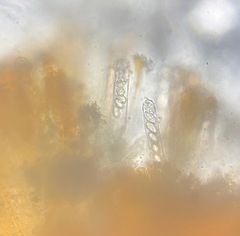 Melastiza cornubiensis