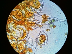 Mycocaliciales