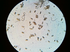 Mycocaliciales