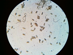 Mycocaliciales