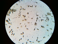 Mycocaliciales