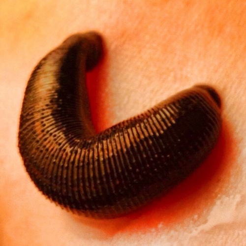 European Medicinal Leech, photo 3 of 7