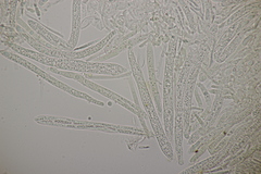 Trichopeziza sulphurea