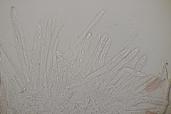 Trichopeziza sulphurea