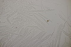 Trichopeziza sulphurea