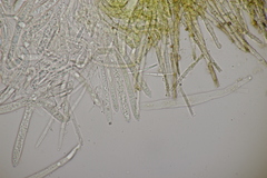 Trichopeziza sulphurea