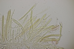 Trichopeziza sulphurea