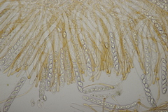 Octospora gyalectoides