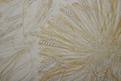 Octospora gyalectoides