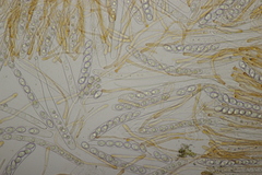 Octospora gyalectoides