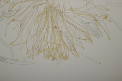 Octospora gyalectoides