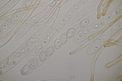 Octospora gyalectoides