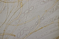 Octospora gyalectoides