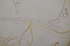 Octospora gyalectoides