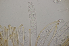 Octospora gyalectoides