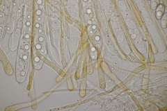 Octospora gyalectoides