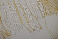 Octospora gyalectoides