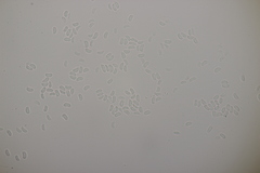 Sistotrema sernanderi