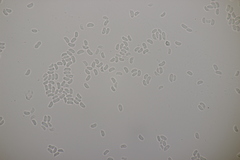 Sistotrema sernanderi