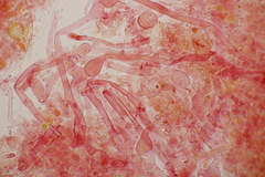 Sistotrema sernanderi