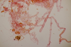 Sistotrema sernanderi