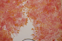 Sistotrema sernanderi