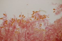 Sistotrema sernanderi