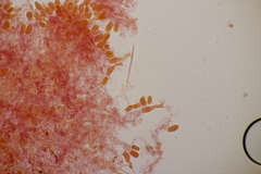 Sistotrema sernanderi