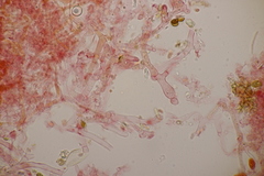 Sistotrema sernanderi