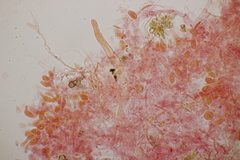 Sistotrema sernanderi