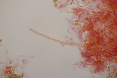 Sistotrema sernanderi