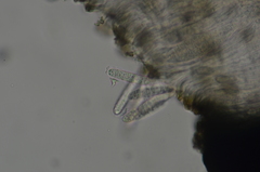 Alyxoria varia