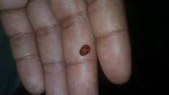 Hemisphaerota palmarum