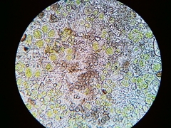 Phaeocalicium populneum