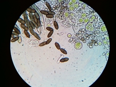 Phaeocalicium populneum